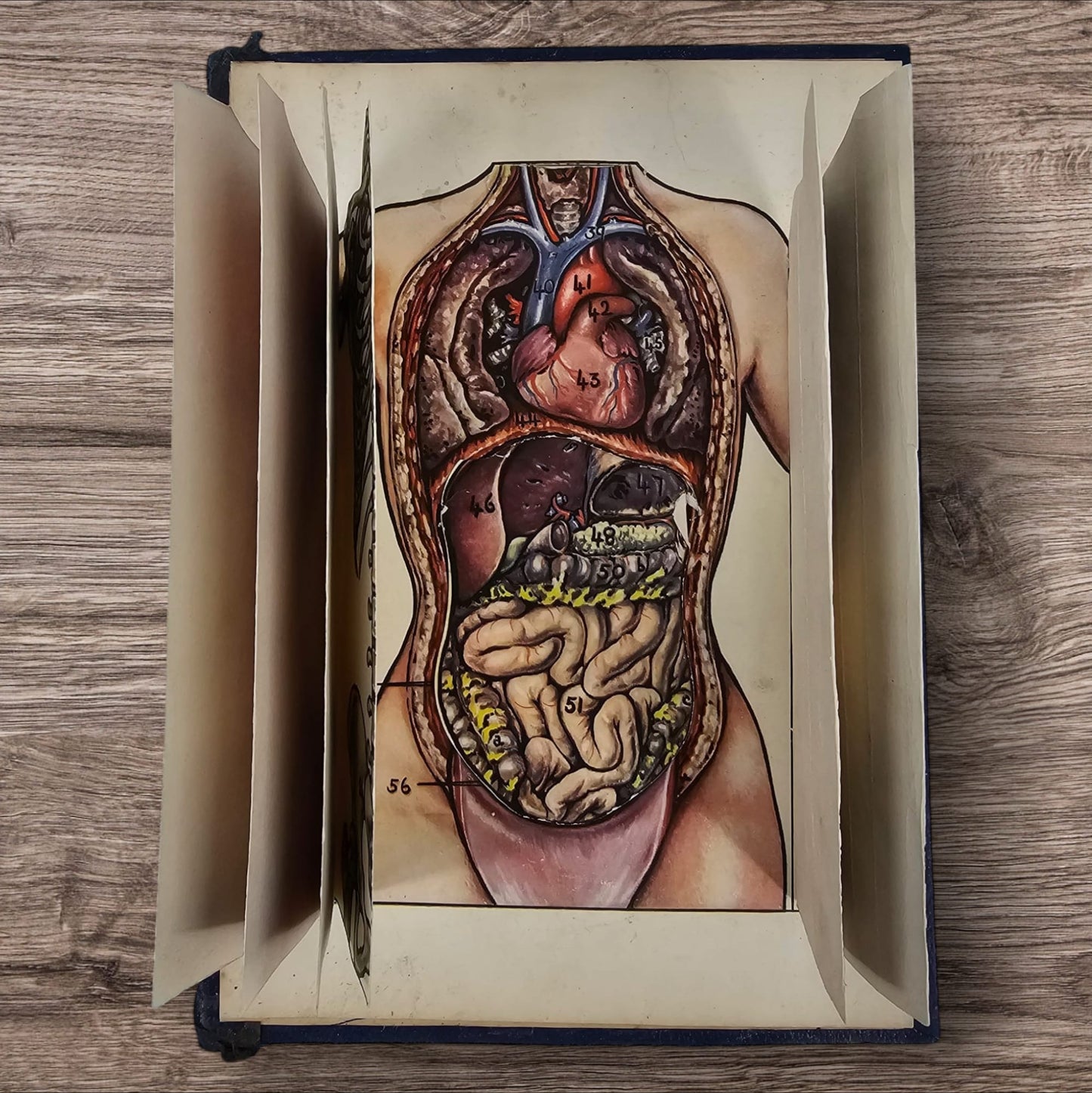 Anatomical Layered Display - Female Torso