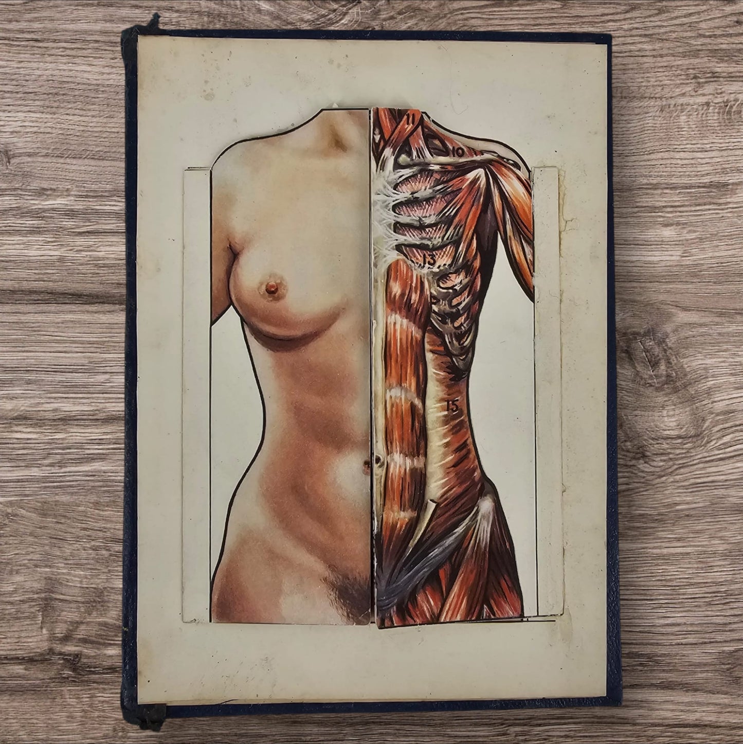Anatomical Layered Display - Female Torso