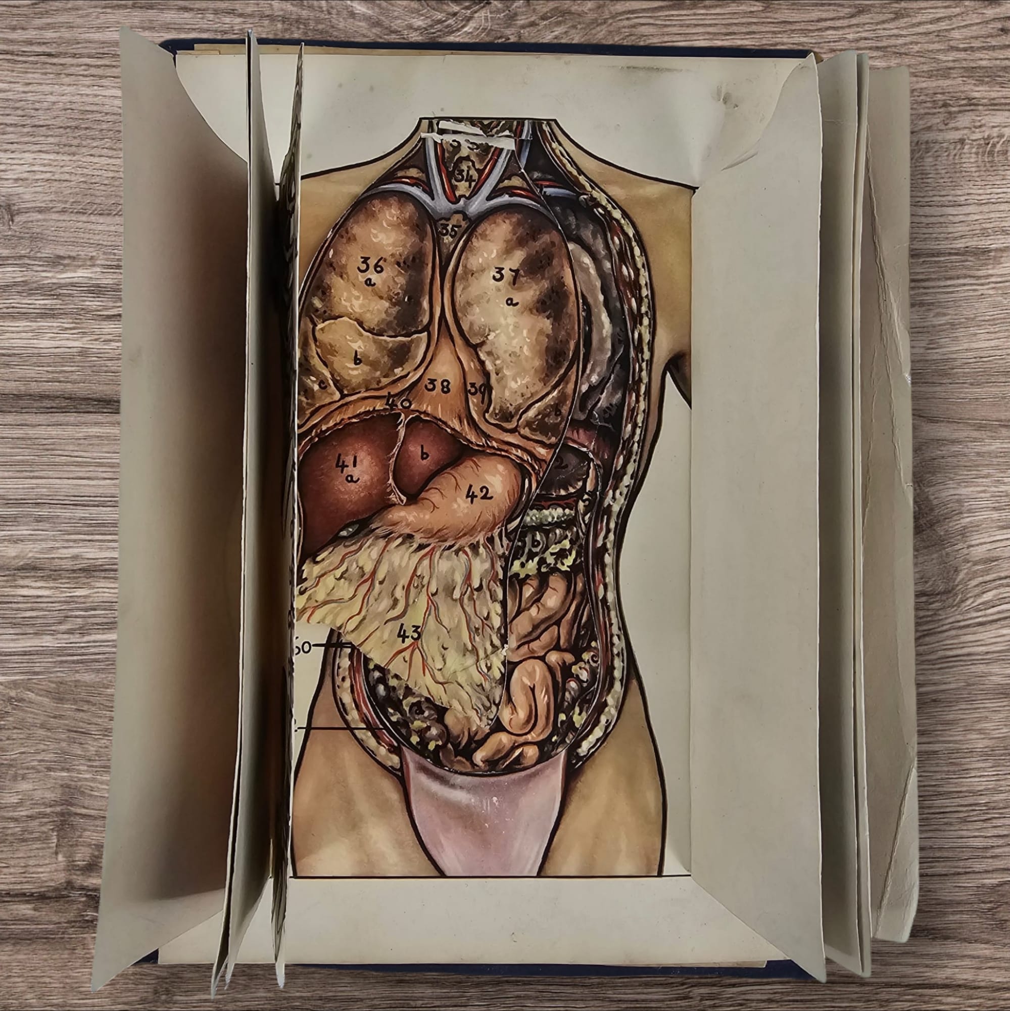 Anatomical Layered Display - Male Torso