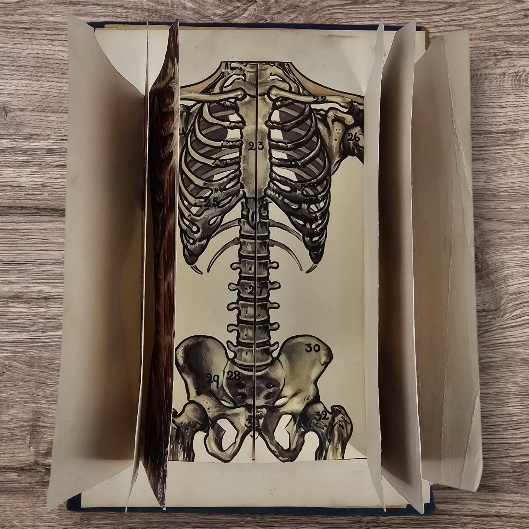 Anatomical Layered Display - Male Torso