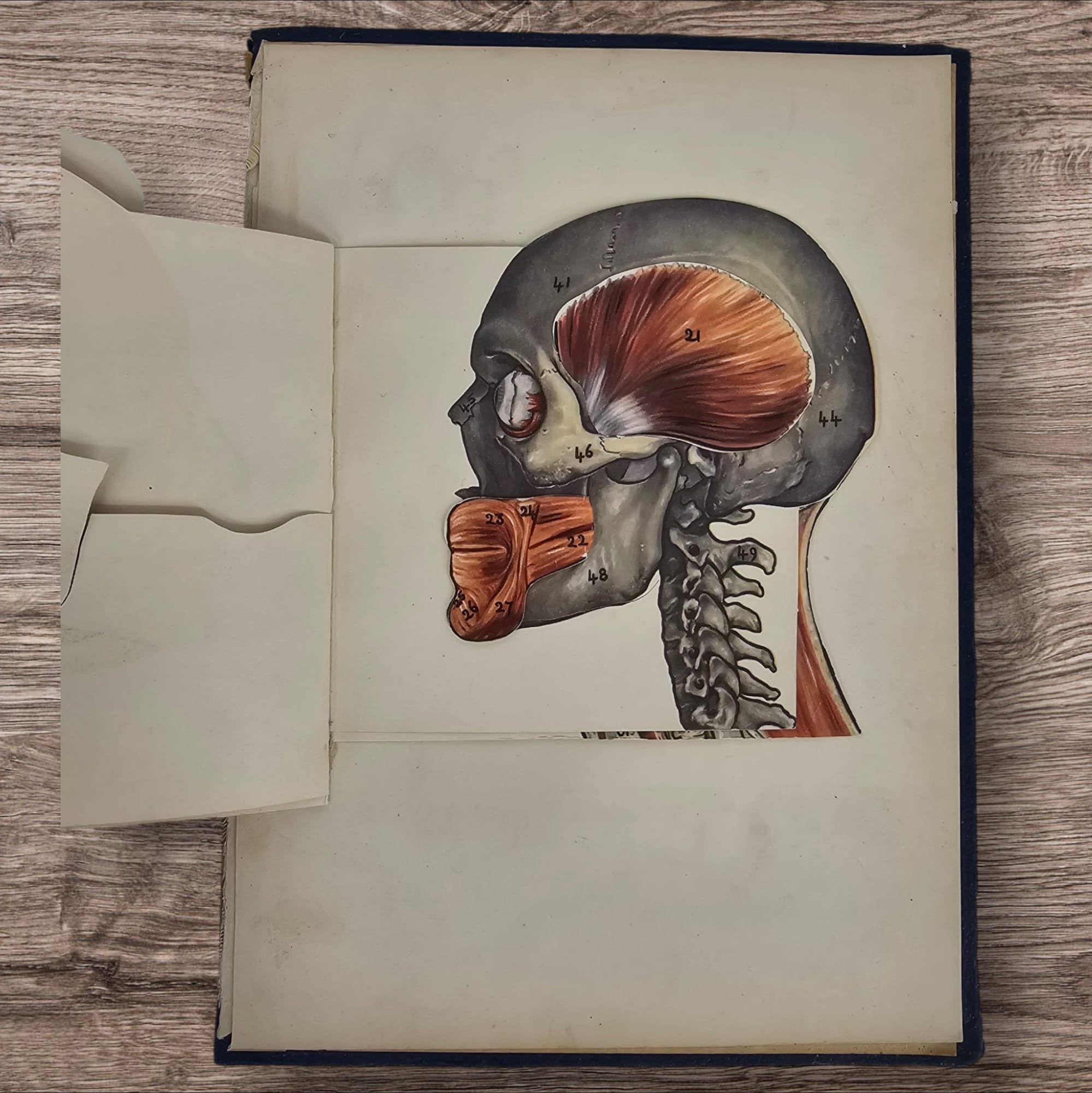 Anatomical Layered Display - Male Head