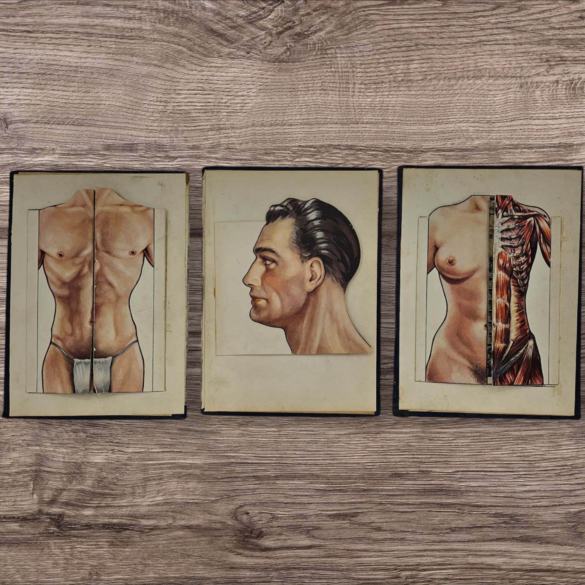 Anatomical Print - Full Term Pregnancy