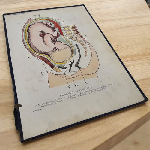 Anatomical Print - Full Term Pregnancy