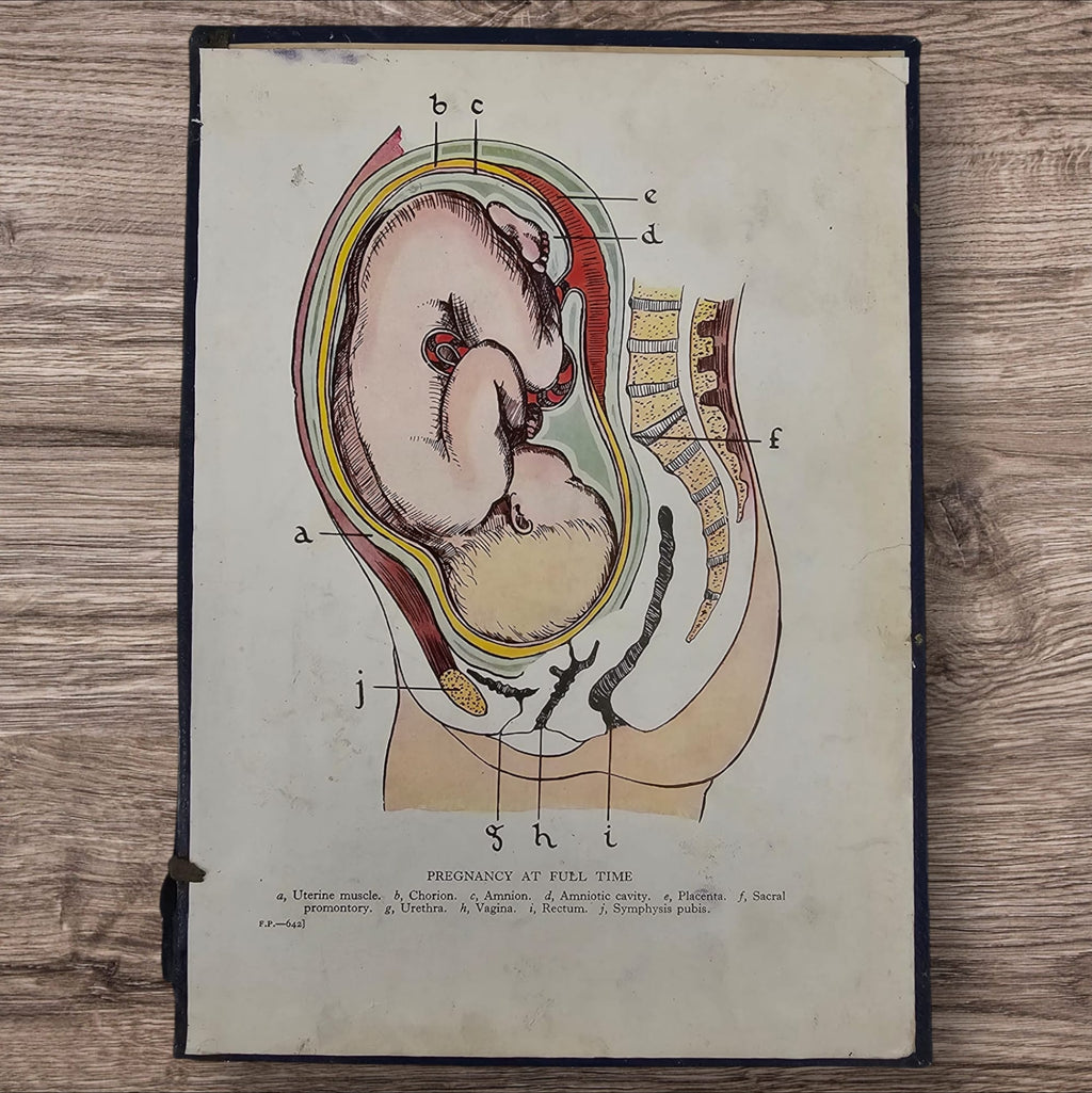 Anatomical Print - Full Term Pregnancy