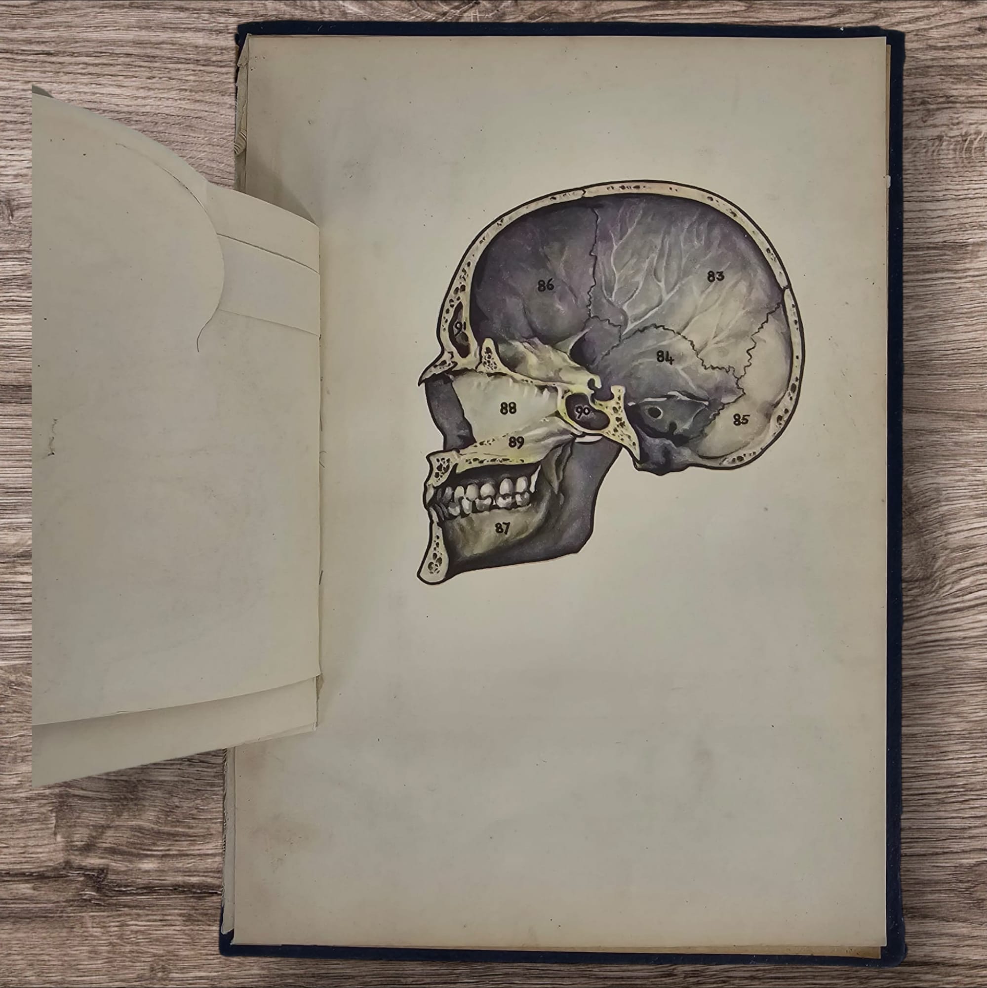 Anatomical Layered Display - Male Head